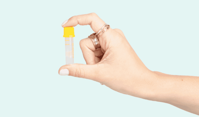 HSE offering free at-home STI test kits until Summer 2021